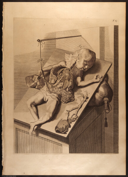 E466 - Anatomy Atlas - Cowper - i0626