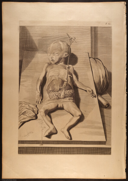 E466 - Anatomy Atlas - Cowper - i0661