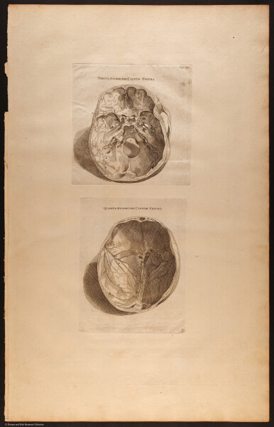 E510 - Anatomy Atlas - Vesalius - i0613